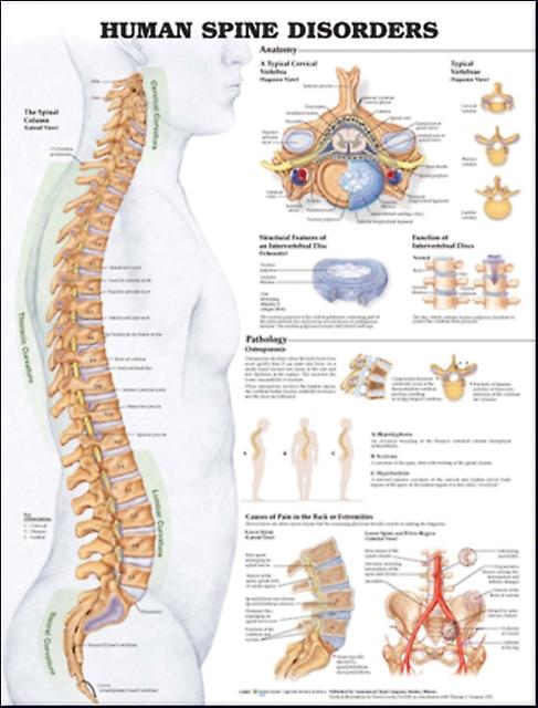 Human Spine Disorders Anatomical Chart Wallchart Book