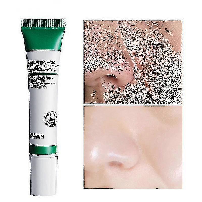 20 ml Salicylsyre Porer Raffinering Creme Krympe Pore Forbedre Acnes Hudorme Whitening Cream Anti-aging Olie Kontrol Hudpleje