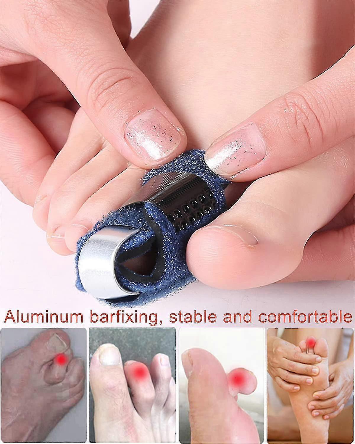 Left Toe Straightener, Breathable Hammer Toe Straightener Toe Splint Fracture Claw Toe Fixation Corrector Strap