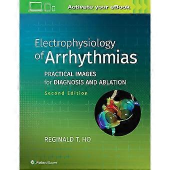Electrophysiology of arrhythmias practical images for diagnosis and ablation