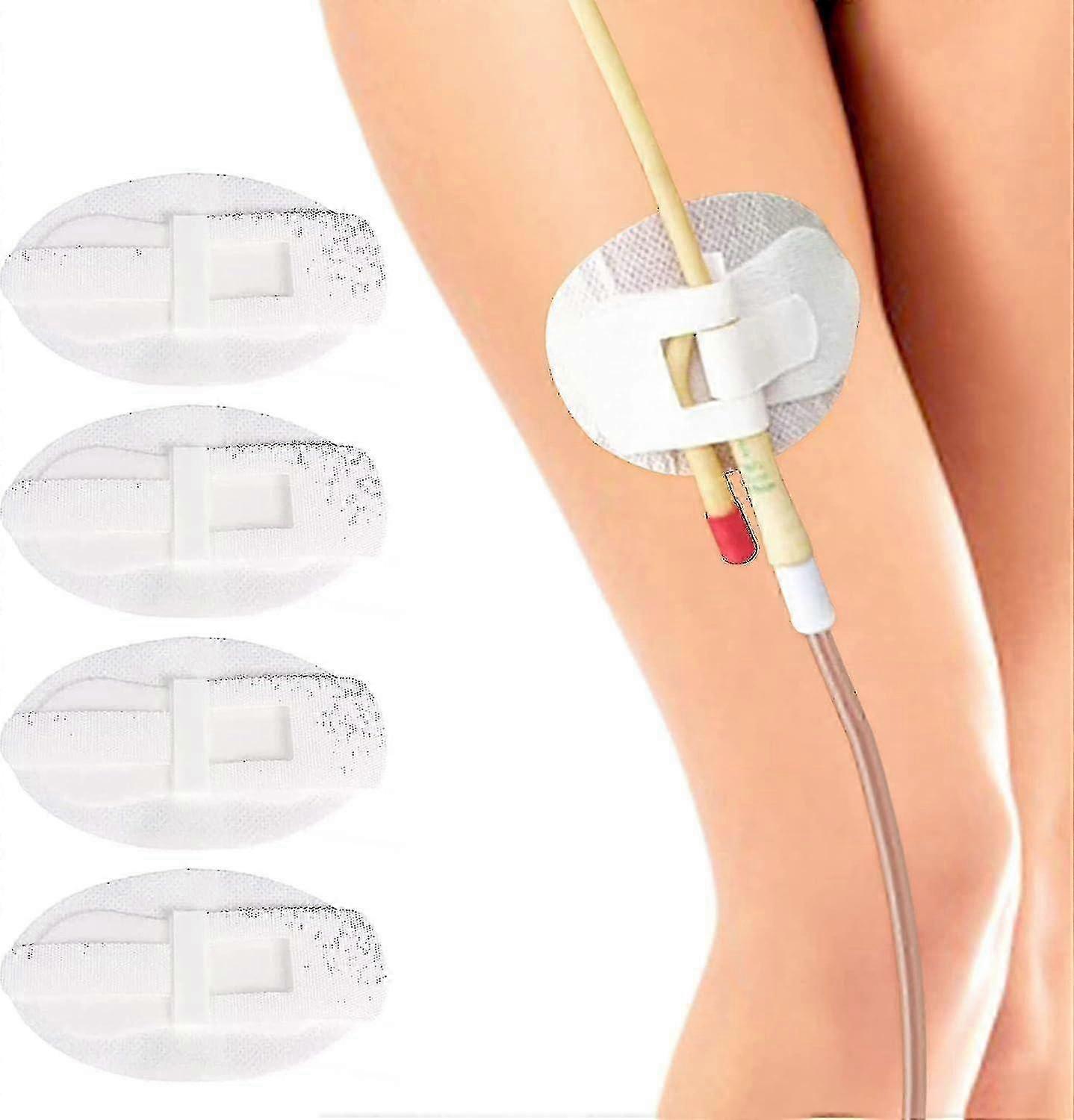 10 Pack Catheter Urinary Leg Bag Legband Holder,statlock Catheter Stabilization Device - JA