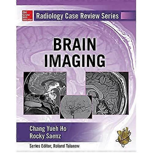 Radiology Case Review Series: Brain Imaging