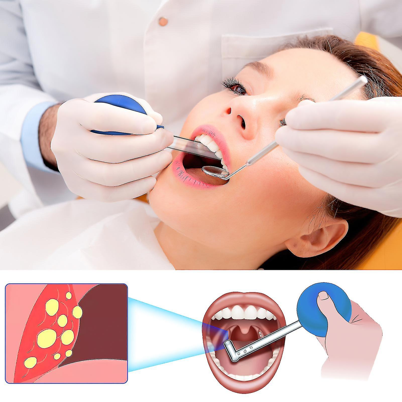 المحمولة اللوزتين الحجر المزيل مع الزاوية اليمنى أنبوب من السهل حمل اللوزتين الحجر مزيل لتنظيف الفم