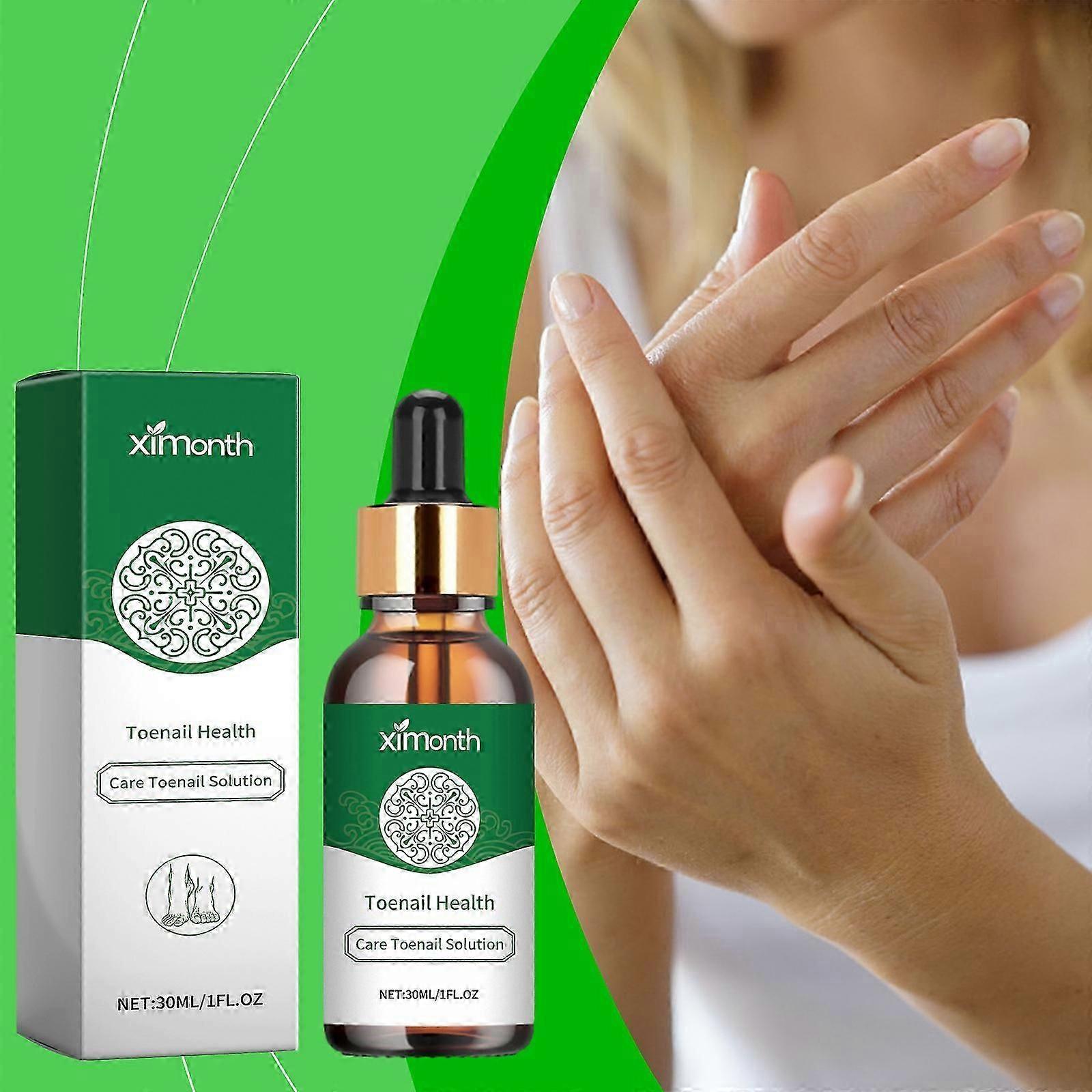 Solution de soin des ongles, Solution de réparation des ongles de 30 ml, Traitement des ongles, Traitement des champignons des ongles, Solution de soin des ongles incarnés