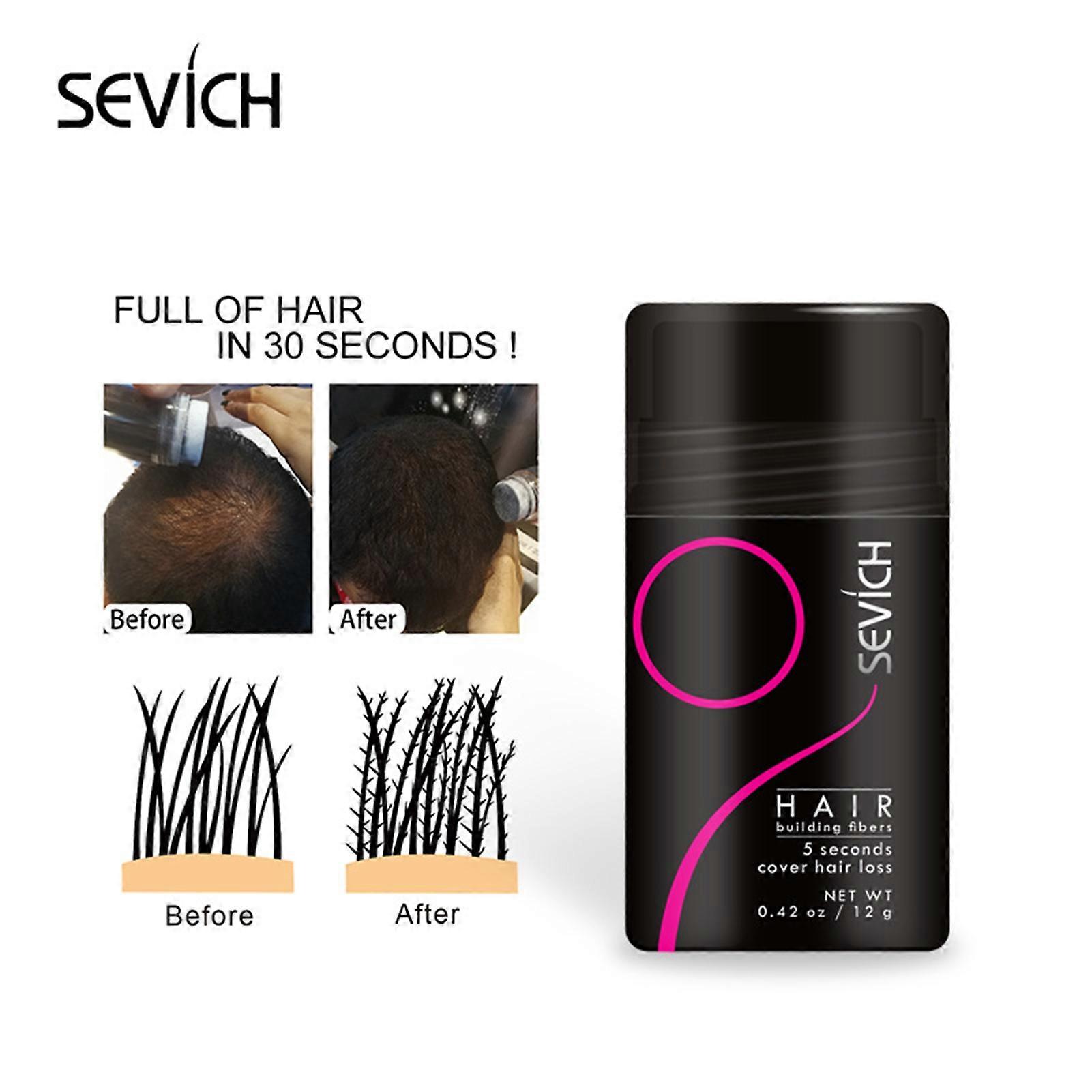Ustar Hair Building Fibers Hair Loss Concealer for Thinning Hair Black 0.42oz/12G Ustar Hair Building Fibers Hair Loss Concealer for Thinning Hair Black 0.42oz/12G