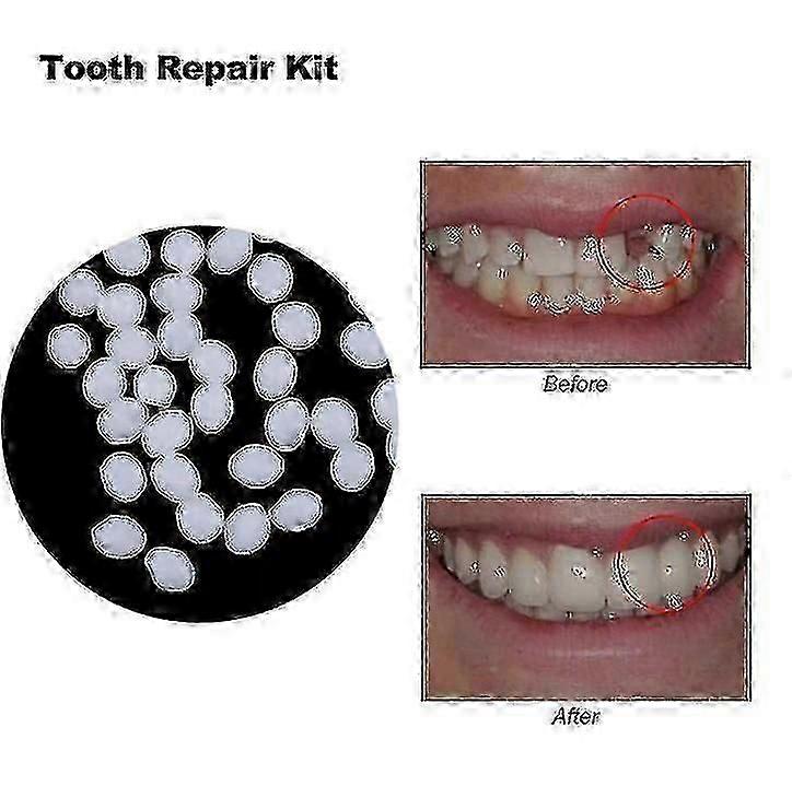 10g/50g/100g Teeth And Gap Falseteeth Pevné lepidlo na zubné protézy Zuby zubára Falseteeth Pevné lepidlo Dočasná sada na opravu zubov