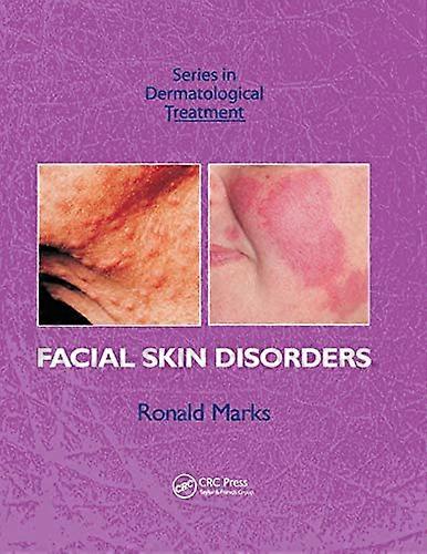 Facial Skin Disorders