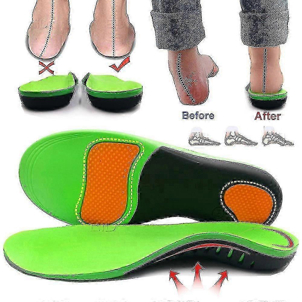 Orthopedic Shoe Insoles for Arch Support - Eva Sole, X/O Type, Leg Correction