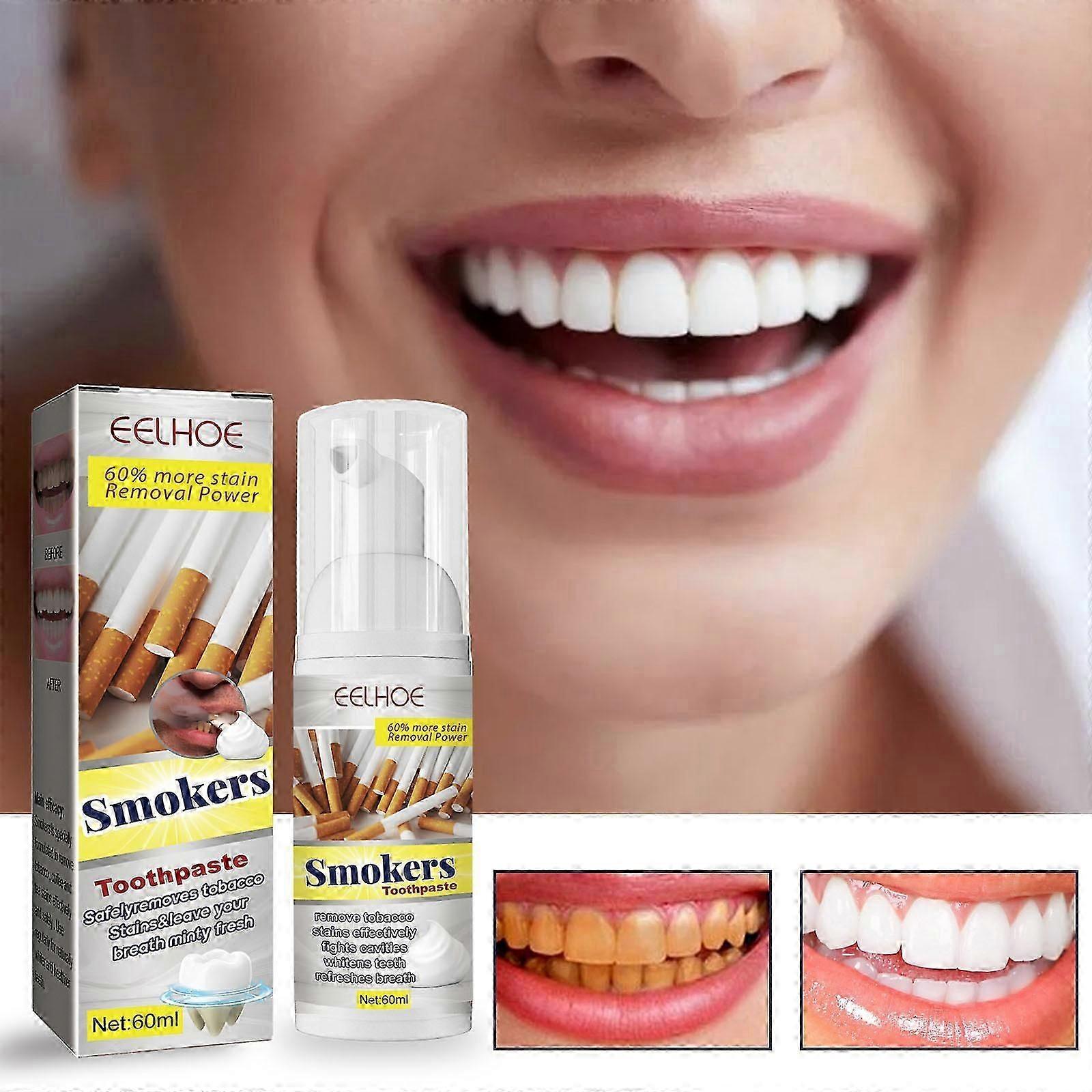 Smoker's toothpaste, smoker's stain-removing and whitening gel, removes smoker's stains from teeth.-L