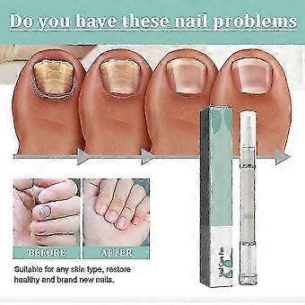 Nail Care Solution Pen with Exfoliating Barbs for Onychomycosis, Moisturizing and Repairing Nail Care Pen