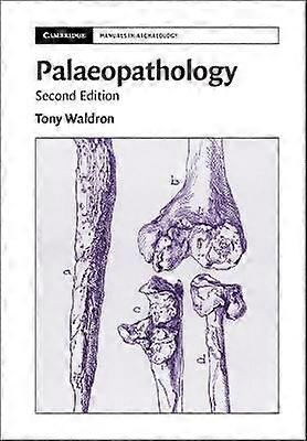 Palaeopathology