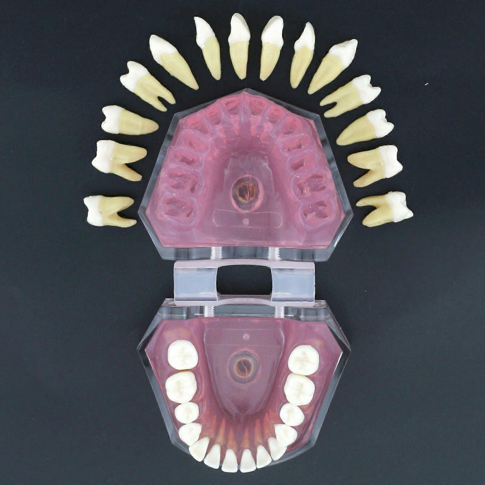 Dental Soft Gum Standad Typodont Study Model with 28pcs Removable Teeth #7008