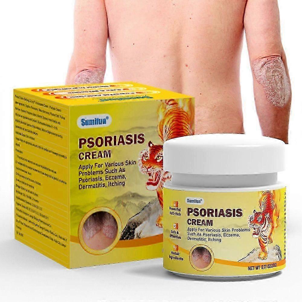 Psoriasis Treatments Cream, Skin Psoriasis Anti-Itch Soothing Cream, Soothing & Calming Formula Moisturiser for Redness and Discomfort
