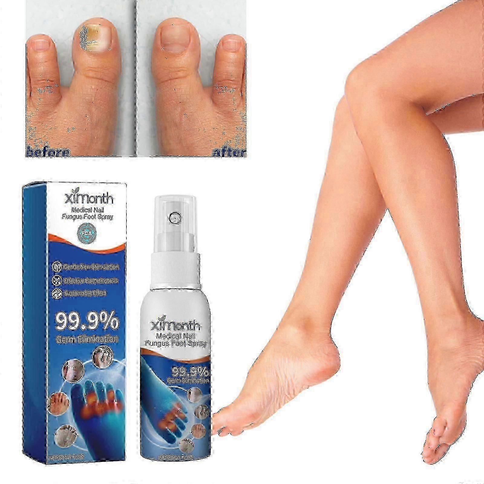 畅销产品真菌足部喷雾剂，护理级足部喷雾剂，足部真菌