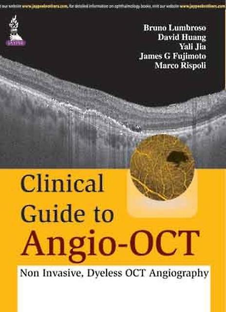 Clinical Guide To Angiooct Non Invasive Dyeless Oct Angiography by Bruno Lumbroso Hardback Book