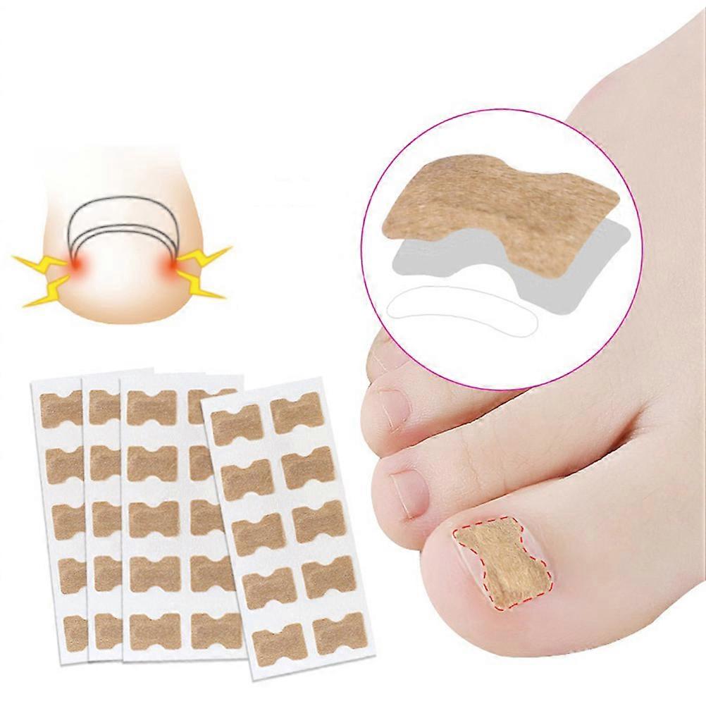 100Pcs Ingrown Toenail Correction Stickers with Double-Sided Tape, Paronychia Corrector, Pedicure Tools