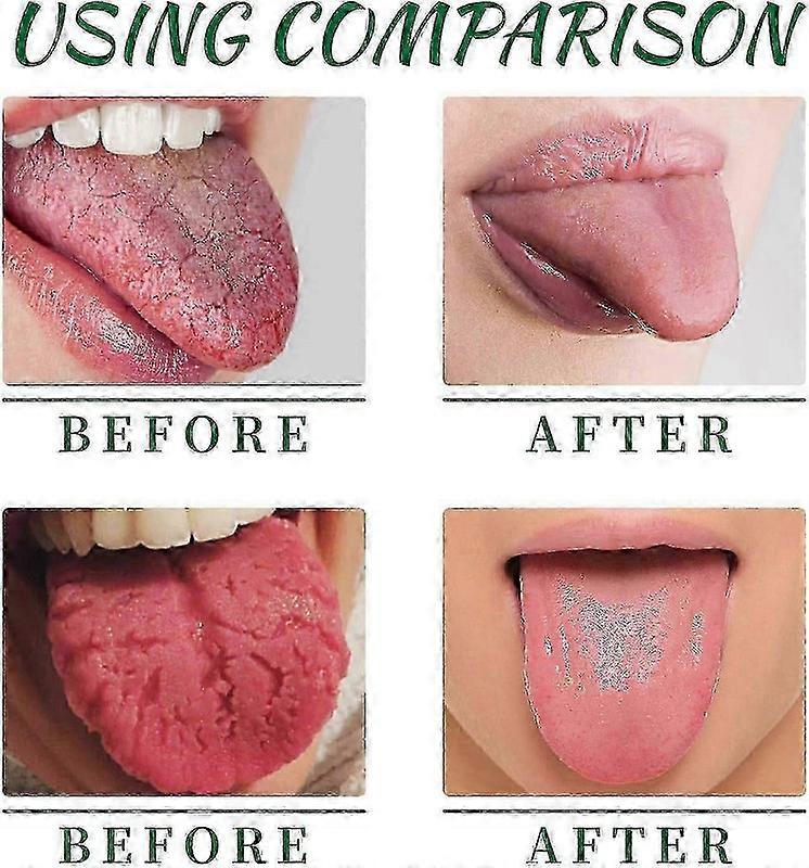 Tørr munnlindringsspray med umiddelbar friskhet