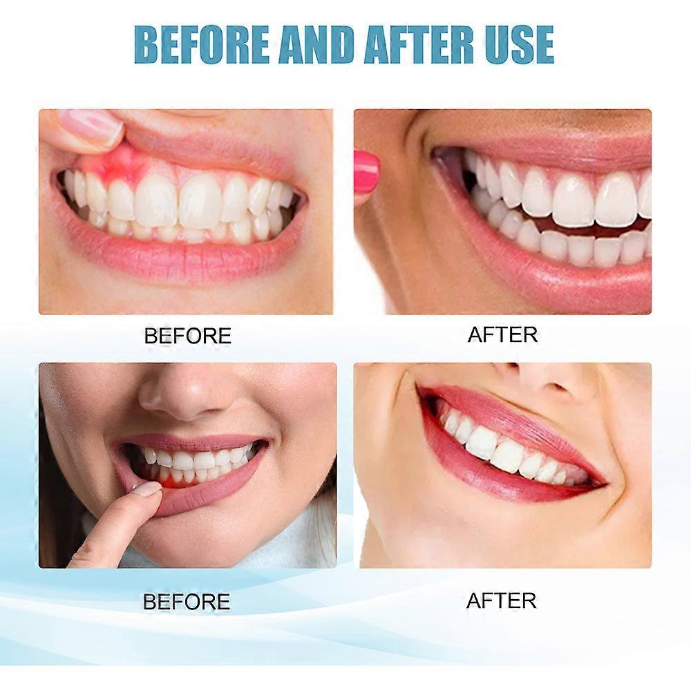 Toothpaste Removes Stains Fresh Breath Tooth Cleansing Refreshing Toothpaste
