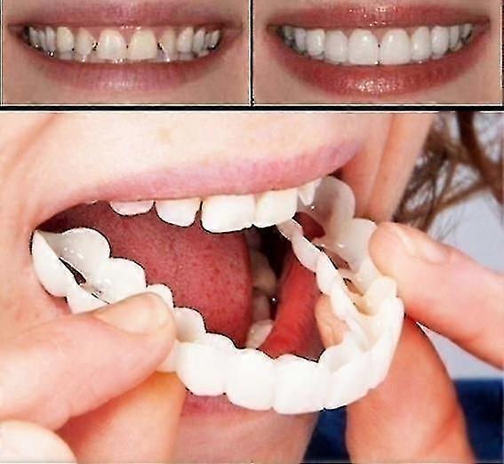 A Pair Upper & Lower High Quality Denture Instant Smile Comfort Fit Flex Cosmetic Teeth Denture Teeth Top Cosmetic Veneer