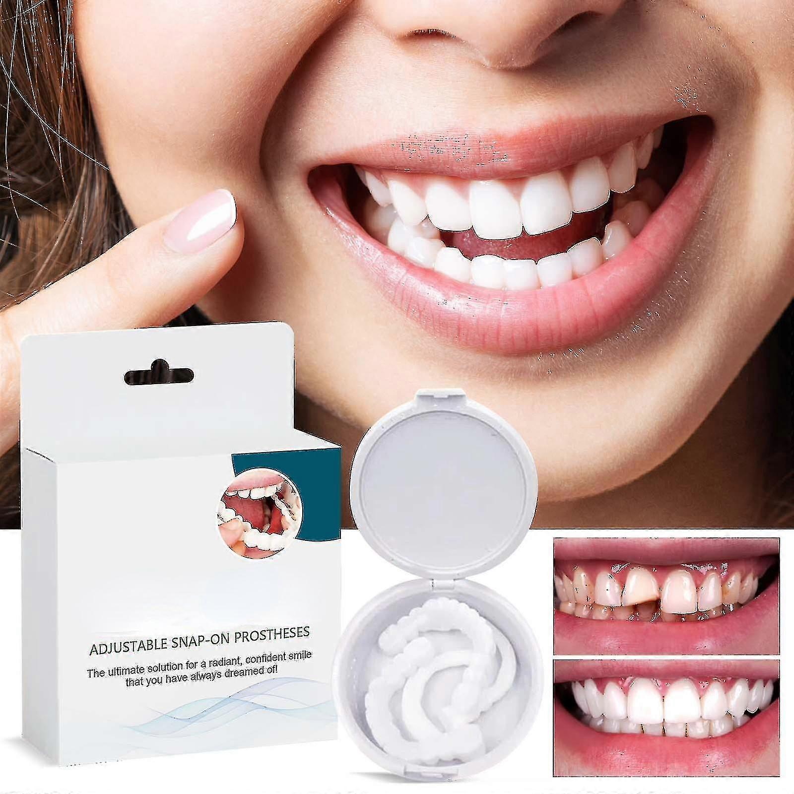 Prothesens à encliquetage réglable, prothèse dentaire réglable Snap On, appareils orthodontiques blanchissants en silicone, couvre les dents imparfaites