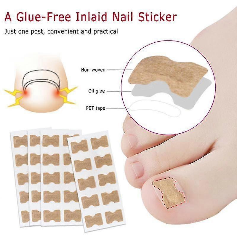 1/5pcs Ingrown Toenail Corrector Sticker Paronychia Remove Fixer Recover Correct