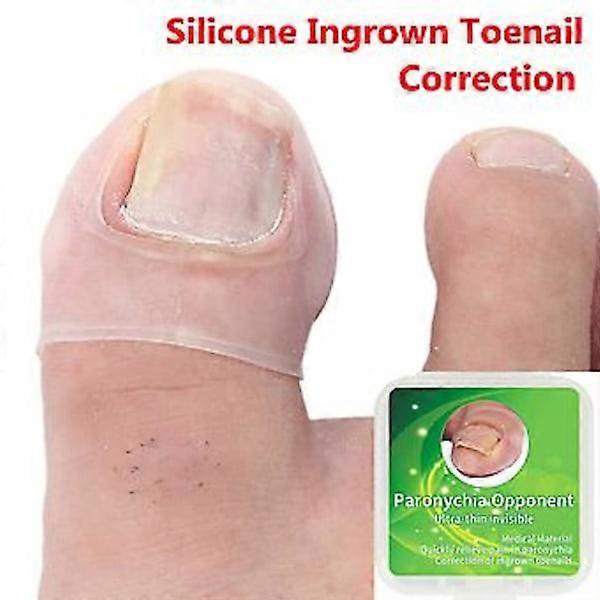 2 pcs Silicone Tools for Correction of Ingrown Toenails Toe Protectors Large Toe Sleeves Thick Tool for Paronychia Correction