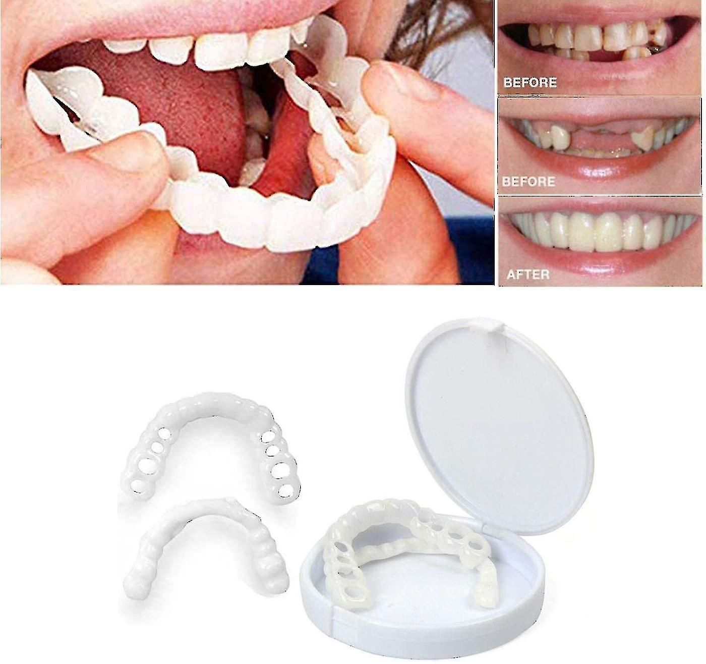 Braces Bite Upper Dentures Veneer Dentures
