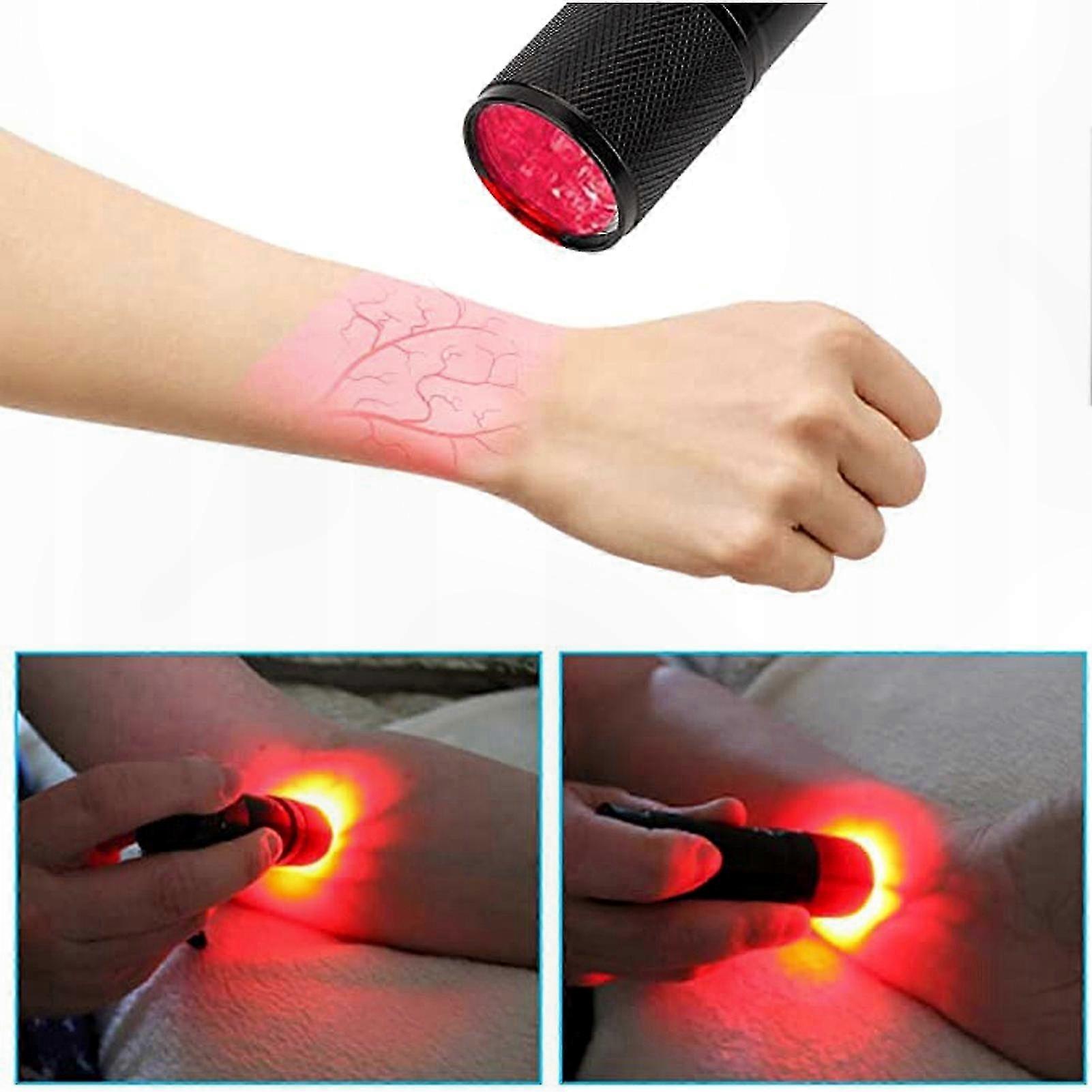 Vein Locator Device for Blood Collection and IV Placement Support