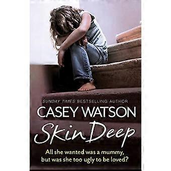 Skin Deep All She Wanted Was A Mummy But Was She Too Ugly To Be Loved - Casey Watson