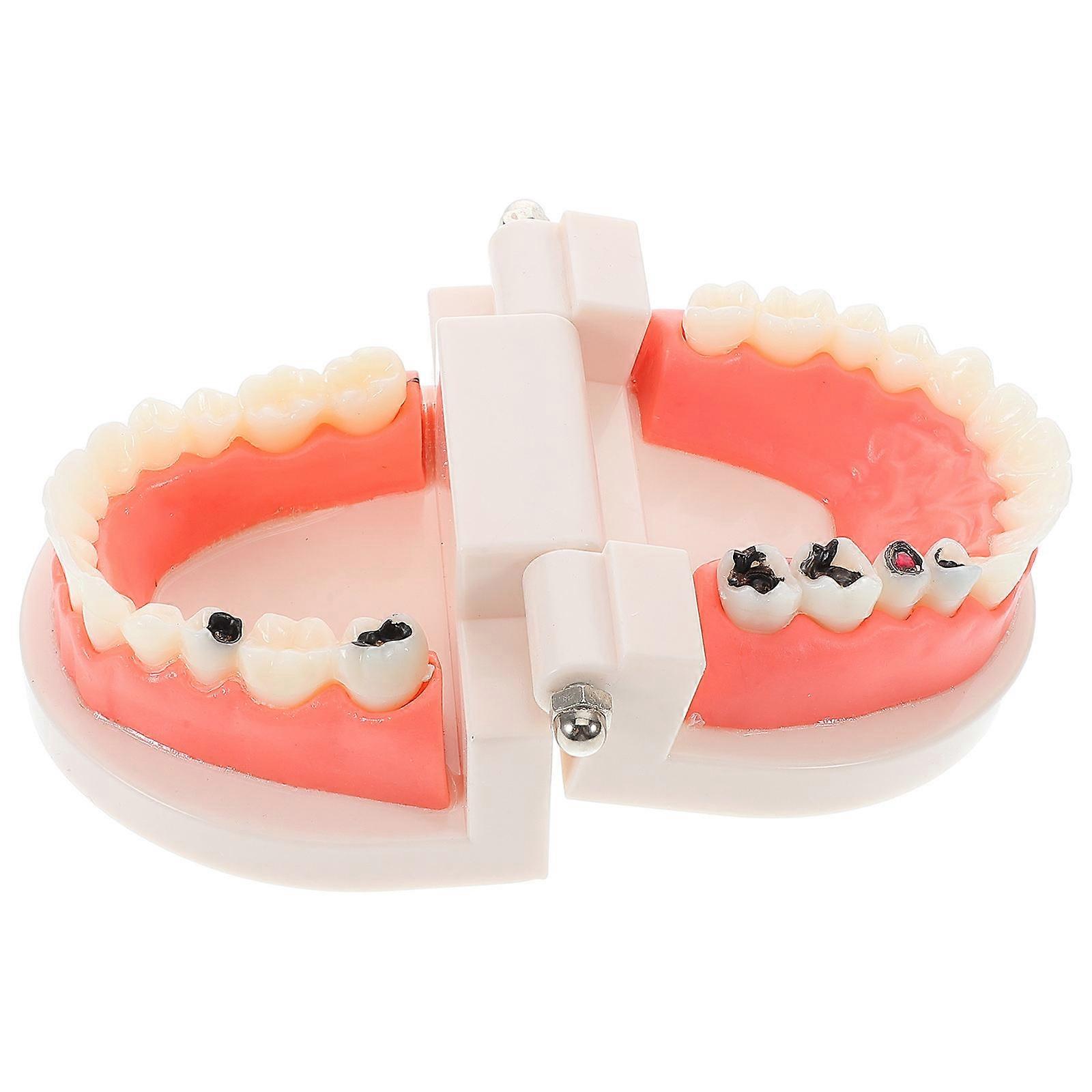 Dentist Standard Demonstration Model for Teaching Removable Teeth Anatomy