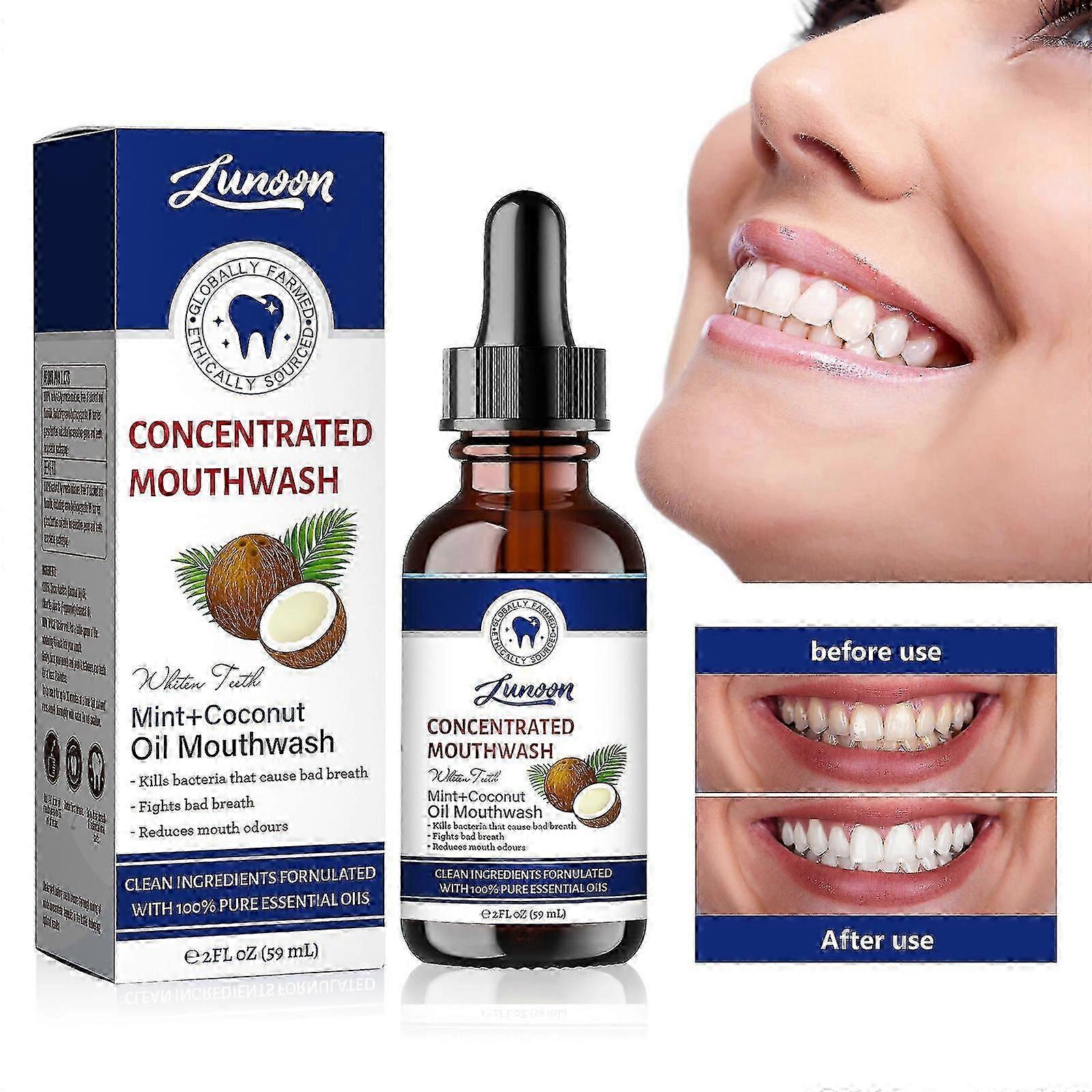 Coconut Oil For Teeth, Alcohol-free With Coconut Oil, Peppermint For Healthy Teeth Gums, Promotes