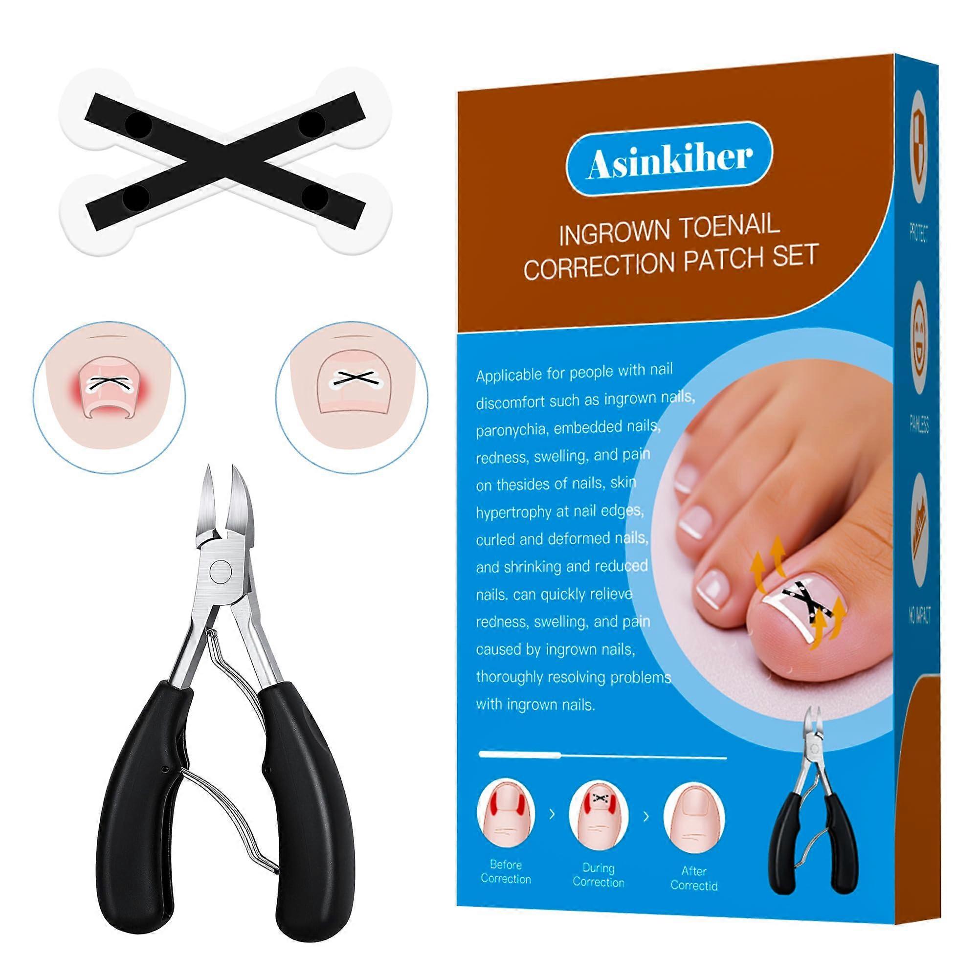 Ingrown Toenail Treatment Kit with Titanium Alloy Corrector, Dual Tension Relief and Clippers, 6 Count