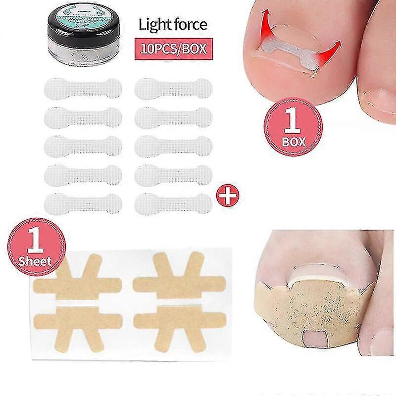 4-20pcs爪矯正ステッカー爪周囲炎治療陥入爪矯正弾性矯正クリップブレースペディキュアツール