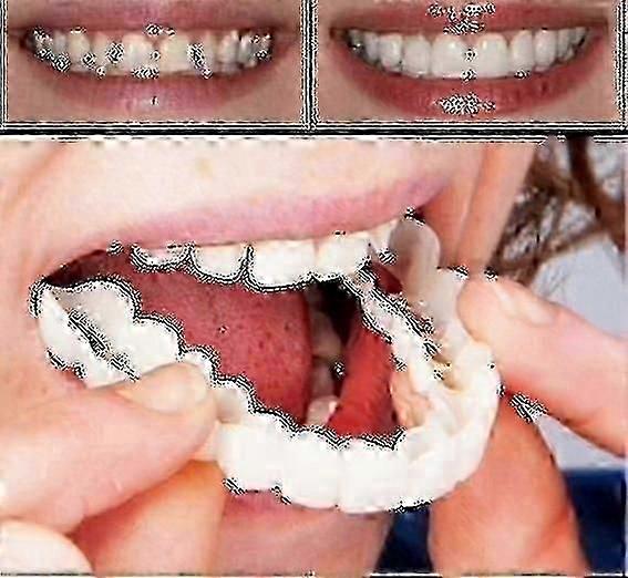 A Pair Upper & Lower High Quality Denture Instant Smile Comfort Fit Flex Cosmetic Teeth Denture Teeth Top Cosmetic Veneer High Quality