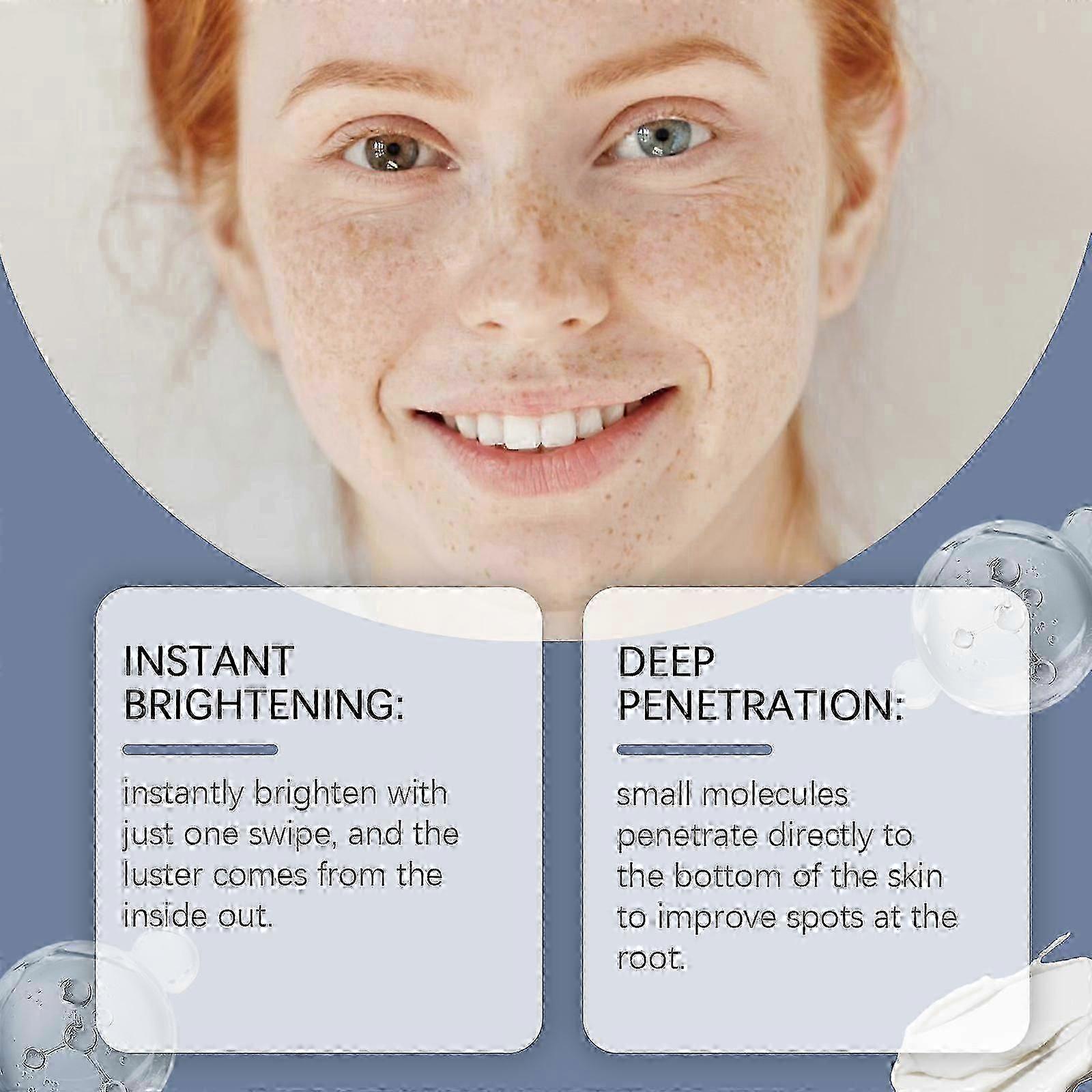Dark Spot Remover for Face, Nicotinamide Freckle Diminishing Cream, Whitening Freckle Cream, Freckles Removal Cream Melasma Removal Depigmenting