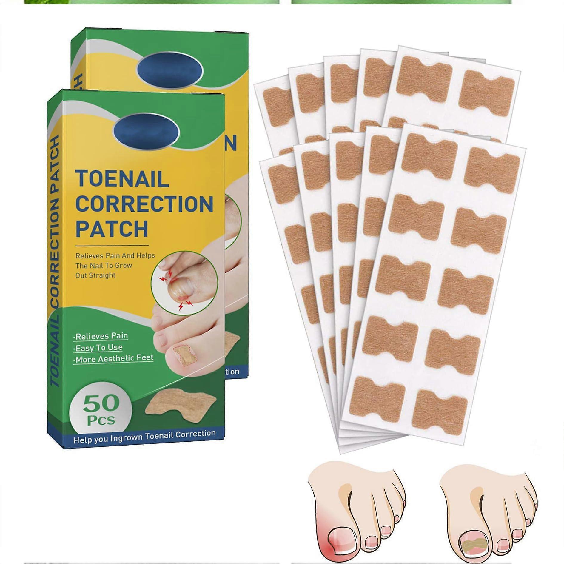 100pcs Toenail Correction Strips Glue Ingrown Toenail Corrector Patch for Easy Nail Alignment