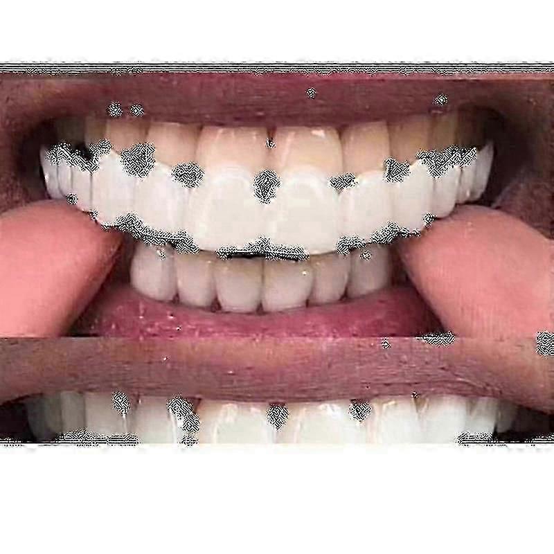 Comfortable dental veneers for teeth, snap on smile flex denture