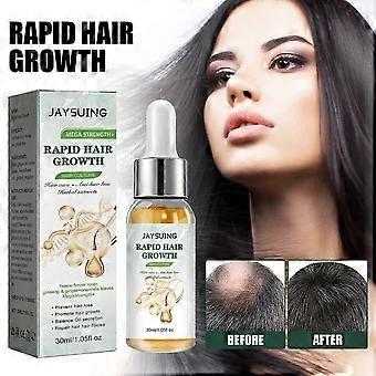 Jaysuing Hair Density Essential Oil - Anti-Hair Loss, Strengthening, Thickening, Nourishing And Repairing Hair Roots, Scalp Massage Nutrient Solution