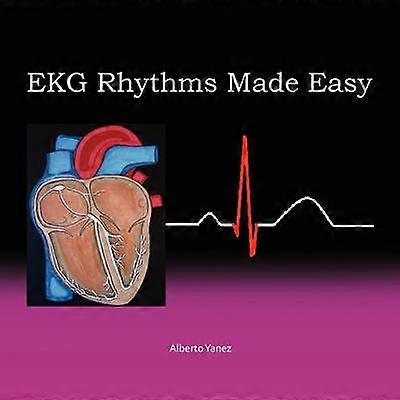 Ritmi ECG semplificati