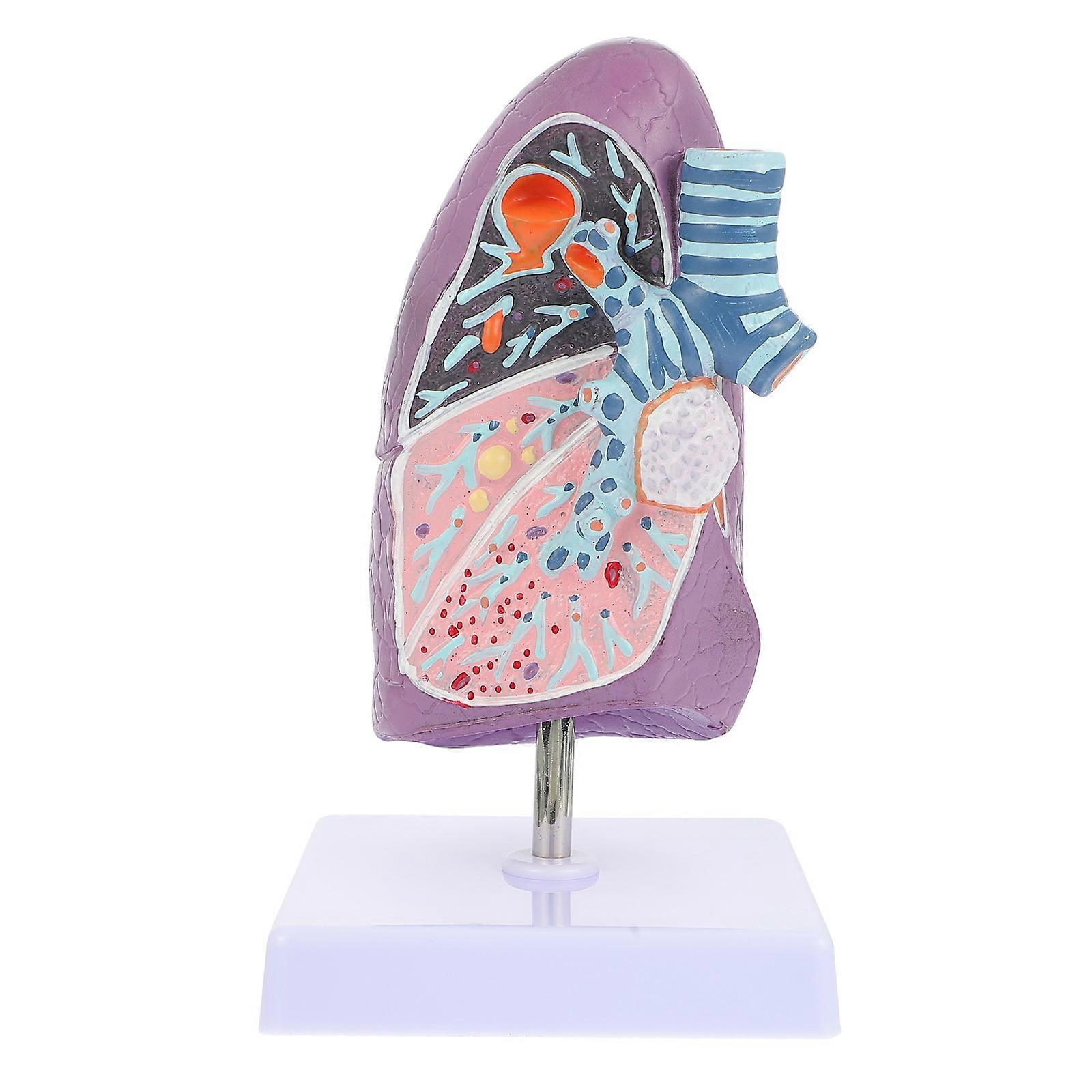 Pathological Smoking Lung Model for Respiratory Anatomy Teaching – Ideal for Schools, Universities, and Patient Education