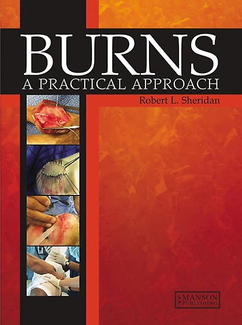 Burns by Robert Sheridan Paperback Book