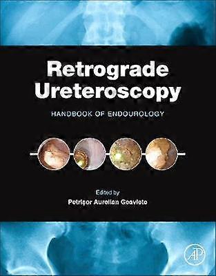 Ureteroscopia retrogradă