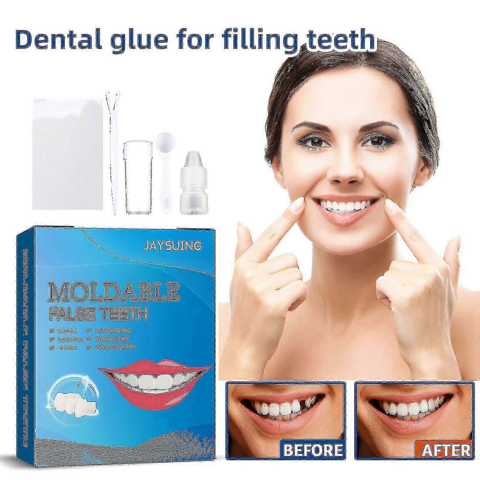 Jaysuing Shapeable Teether Kit Party Makeup Temporary Filling Cavities and Gaps Filling Dentures Modification