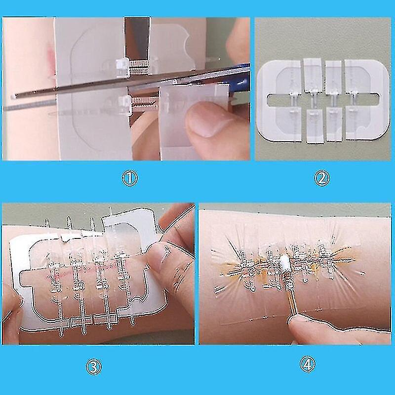 10pcs φερμουάρ γραβάτα κλείσιμο πληγών patch αιμοστατικό έμπλαστρο πληγή γρήγορο ράμμα φερμουάρ ζώνη-ενίσχυση υπαίθρια φορητή φροντίδα του δέρματος