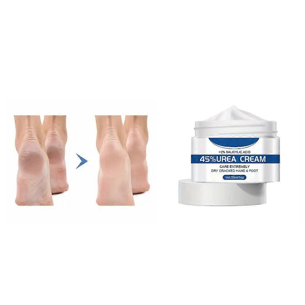 Urea Cream 45% Max Strength Callus Remover Ενυδατώνει &; Μαλακώνει Ξηρό Ραγισμένο