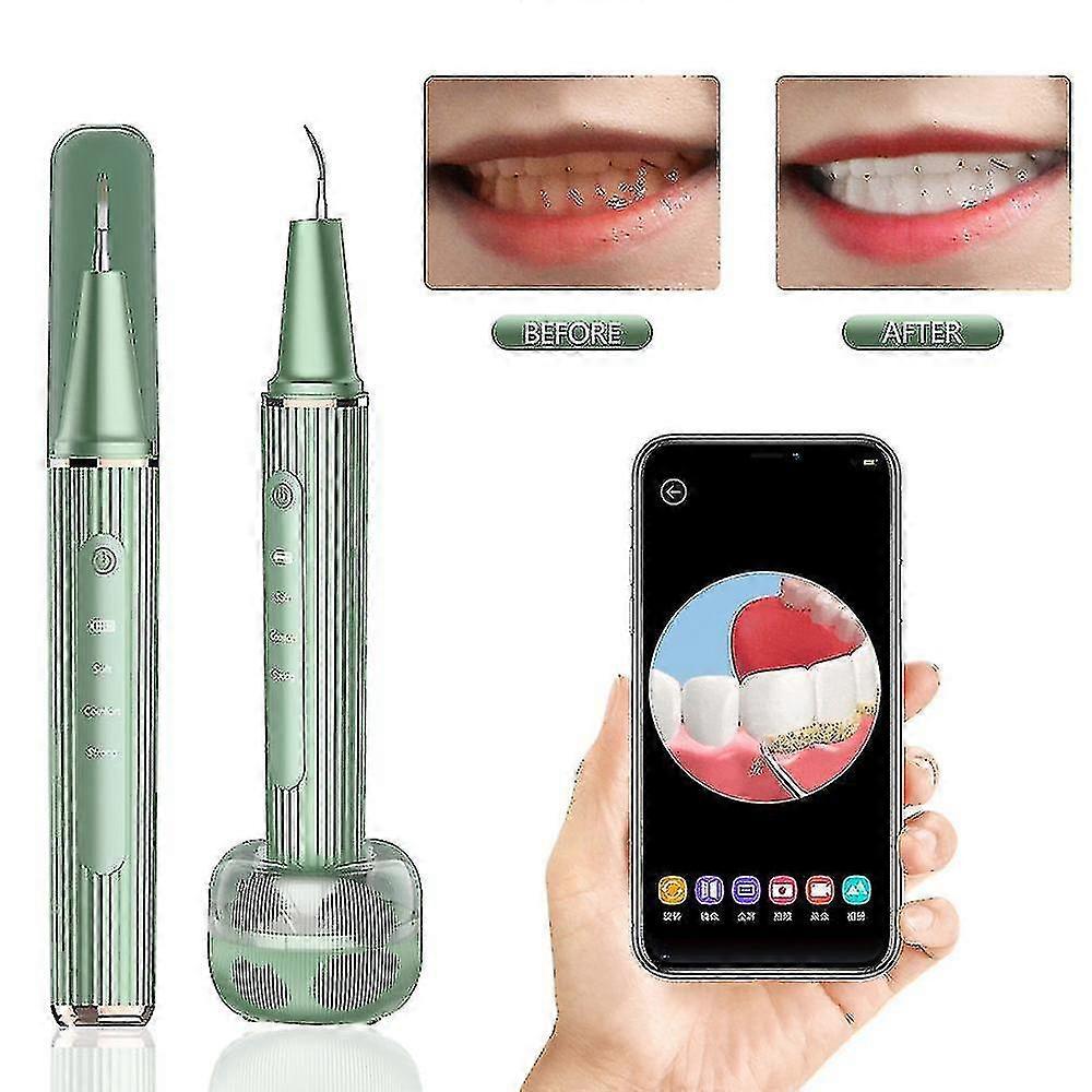 家庭用超音波歯石除去器 電動ポータブルスケーラー 音波煙 歯垢 歯石 歯垢除去 歯のホワイトニング