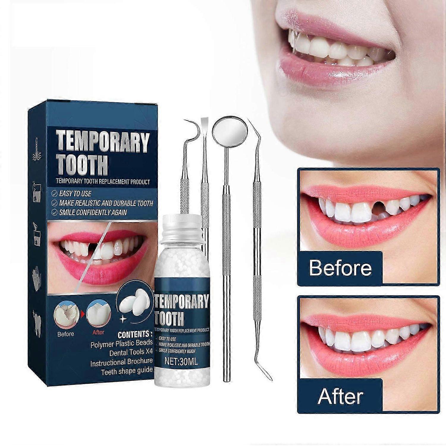 Tooth Repair Kit, Temporary Teeth Filling Repair Kit, Missing and Broken Tooth Replacements Restore 
