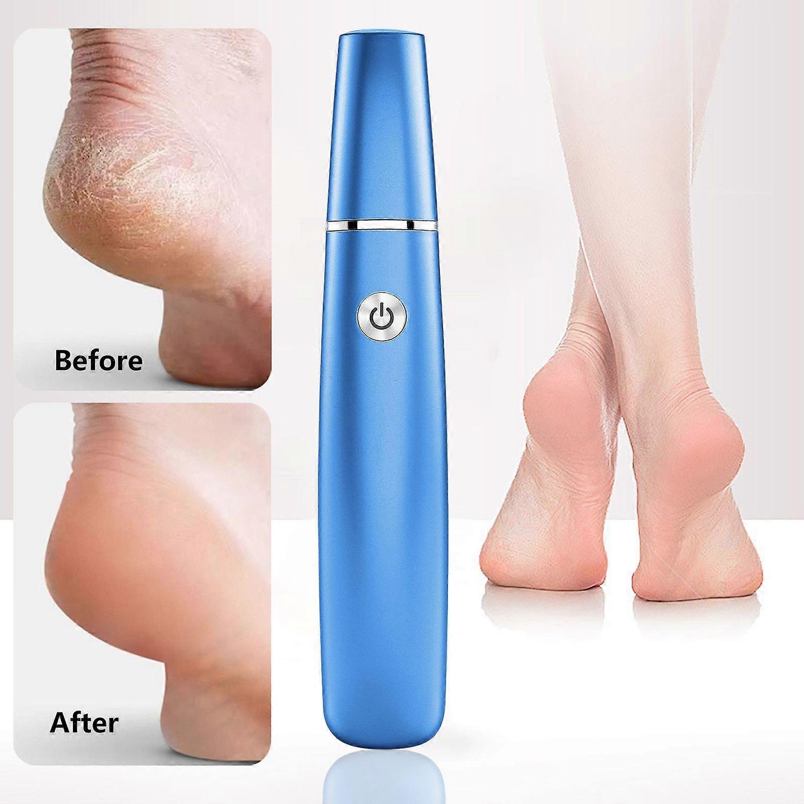 Charging Foot File With Multiple Speeds - Portable Callus Remover For Home Use FYLE8849