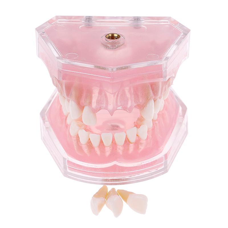 Dental Orthodontic Typodont Plastic Standard Model 4004 With 28 Removeable Teeth