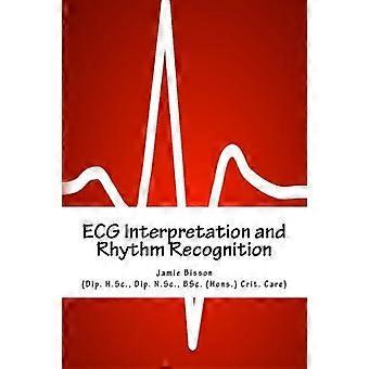 EKG-tolkning og rytmegjenkjenning